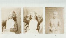 Dr Frederic Truby King (attributed), Johanna Becket, 1890 Albumen prints mounted in casebook from Seacliff Asylum, 10 x 23 cm Archives New Zealand Te Rua Muhara O Te Kawanatanga, Dunedin regional office 